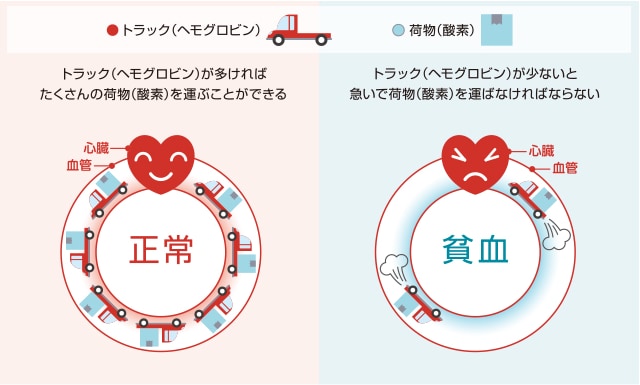 貧血 手 の しびれ 生理