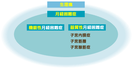 月経困難症イメージ図