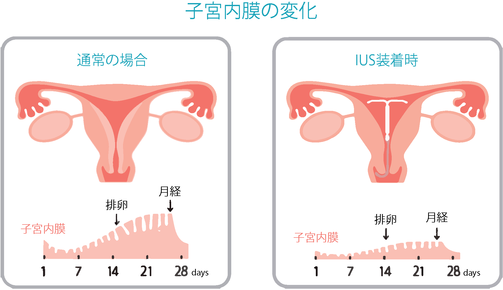 子宮内膜の変化