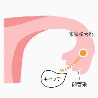 卵管采が卵子を取り込む。
