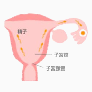 精子が卵管へ向かって進む。