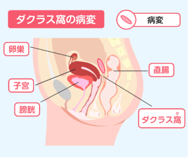 二人のコミュニケーション、痛いのにガマンしていませんか?