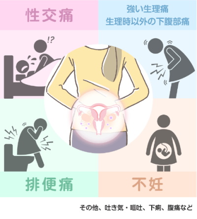 月経周期の異常
